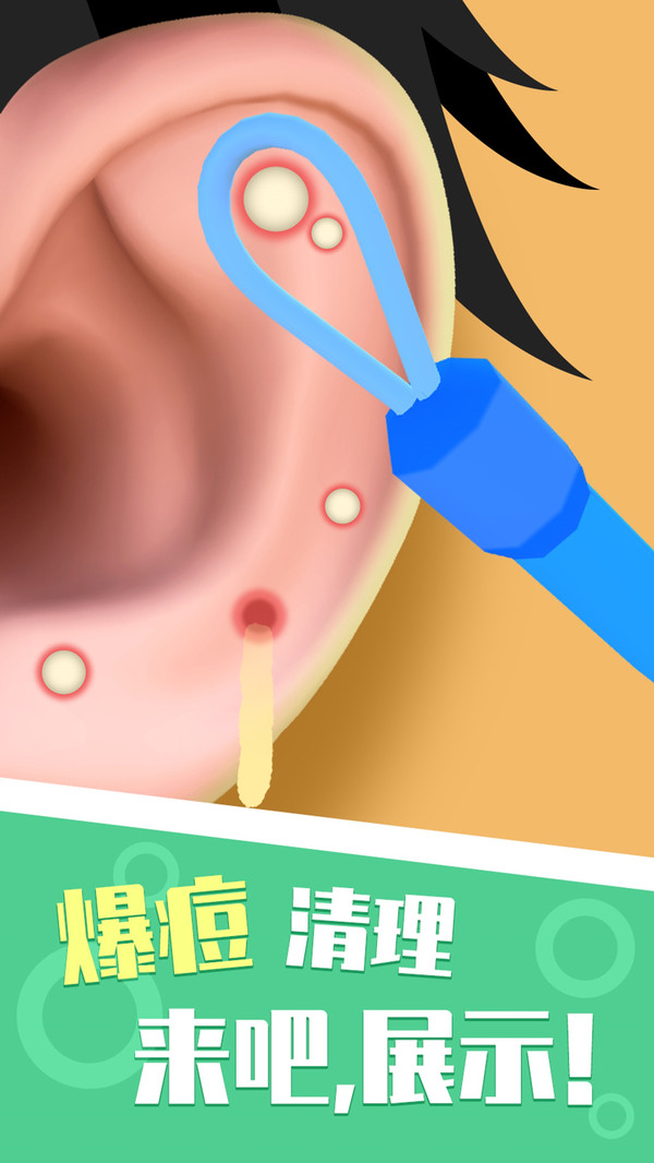 你是来掏耳屎的吧截图展示2